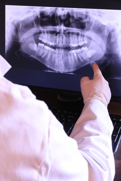 Best Emergency Dental Care for Abscessed Tooth in Friendswood, TX